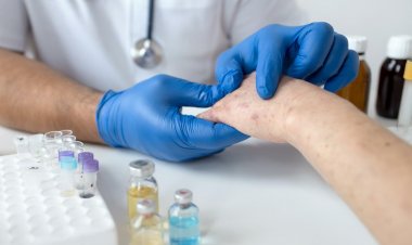 VARÍOLA DOS MACACOS: Drª Natalia Pasternak esclarece dúvidas sobre a doença